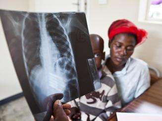 Primrose and her child Panashe as doctors confirm the seven-year-old boy is suffering from TB. 